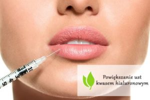 Такие процедуры, как увеличение губ гиалуроновой кислотой, становятся все более и более популярными